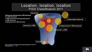 Ultrasound of the Myometrium by Mindy H Horrow MD FACR FSRU FAIUM [upl. by Navinod361]