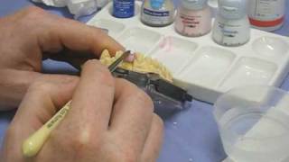 Restoring a tooth CADCAM Ceramic  Part 3 [upl. by Eluk652]