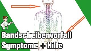 Bandscheibenvorfall Symptome  10 Maßnahmen um ihn zu beheben ✅ [upl. by Oiramat]