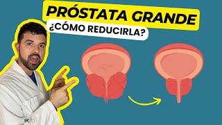 PROSTATA GRANDE Descubre Cómo Reducir la Próstata [upl. by Kimberlyn]