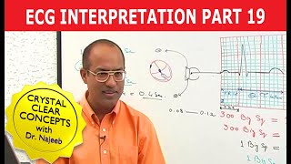 EKG or ECG Interpretation  Part 1920 [upl. by Ecniuq]