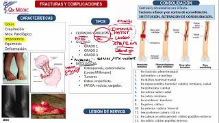 Fracturas Generalidades  Ortopedia y Traumatología Clases Qx Medic  01 [upl. by Ahsitan]