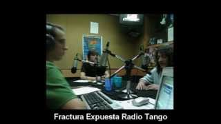 20 minutos con Peche en Fractura Expuesta Radio Tango  Buenos Aires Negro [upl. by Irrep]