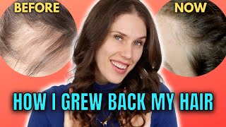 10 Best amp Worst Hair Growth Treatments That I’ve Tried At Home [upl. by Wood]