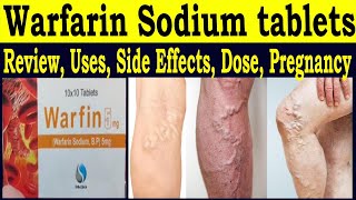 Reiew warfarin 5 mg tablet  Warfarin sodium 5mg tablet Uses in Hinsi  Uses Side Effects Dose [upl. by Anelak]