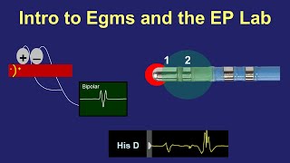 Intro to Intracardiac Electrograms amp the EP Lab [upl. by Christoph805]