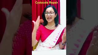 Cystocele Repair 👩‍⚕️ 3 Basic Principals [upl. by Atalie196]