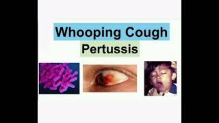 Pertussis mrcpch Communication [upl. by Dodi774]