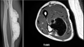 MSK Radiology Spotters radiopediafrcrctmrixraybonestipsamptricksmusculoskeletalexamscases [upl. by Nagaet]