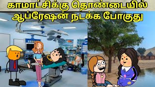 காமாட்சிக்கு ஆப்ரேஷன் நடக்க போகுது  nettavalli comedy  Tirunelveli slang [upl. by Raseac122]