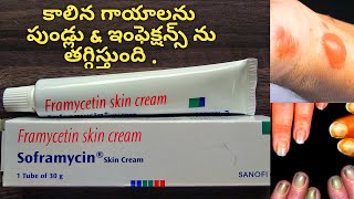 Allergies and skin Burns with soframycin cream in allopathic in Telugu l wounds l scabies l nails [upl. by Asirrom]