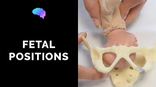 Types of Fetal Positions  OSCE Guide  UKMLA  CPSA [upl. by Zampardi716]