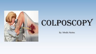 OampG Colposcopy  for medical students indications procedure abnormal results [upl. by Einre]