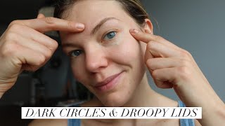 Droopy Eyelids amp Dark Circles Massage [upl. by Nahtonoj]