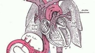 Why does Aortic Rupture cause so many deaths [upl. by Henden]