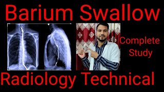 Barium swallow Test  Indication Contraindication Procedure  complete study  By BL KumawatI [upl. by Tamiko630]