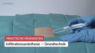 Infiltrationsanästhesie – Grundtechnik  Praktische Fähigkeiten  AMBOSS [upl. by Silliw964]