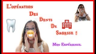 Lopération des dents de sagesse  Je vous dis TOUT [upl. by Droflim242]