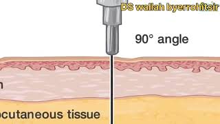 Practicaltypes of injectionscience magic ytshorts viralvideo experiment subscribe ds wallah [upl. by Bate339]