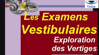 Différents examens vestibulaires diagnostic des vertiges [upl. by Asseret]