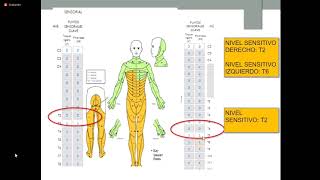 REHABILITACION EN LESIONES MEDULARES [upl. by Ynner]