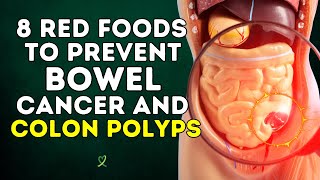 8 Red Foods To Prevent Bowel Cancer And Colon Polyps [upl. by Walcott51]