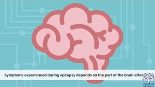 EPILEPSY Causes Signs and Symptoms Diagnosis and Treatment [upl. by Desdee]