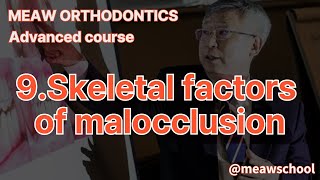 9Skeletal factors of malocclusion [upl. by Aihsit]