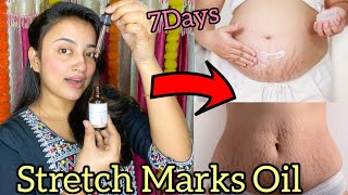 Stretch Marks Oil  7Days Stretch Marks Remove Oil  How to Remove Stretch Marks [upl. by Aidnyc]