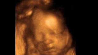 30 Weeks Baby 3D 4D Ultrasound  My Sunshine Baby Ultrasounds [upl. by Daniele378]