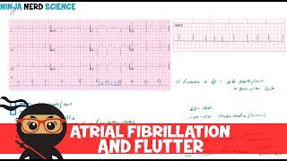 Rate and Rhythm  Atrial Fibrillation and Atrial Flutter [upl. by Rudolfo]