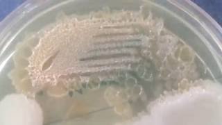 Moraxella lacunata  Pitted colonies [upl. by Revorg]