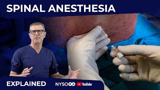 Spinal Anesthesia Explained Part 1 Crash course with Dr Hadzic [upl. by Eneja]