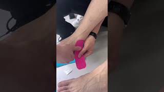 Using kinesiology tape can help prevent heel injuries and relieve heel pain [upl. by Dira]