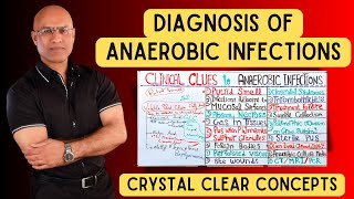 Diagnosis of Anaerobic Infections  Clinical Clues [upl. by Marcell544]