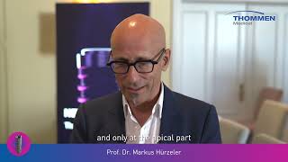 NEVO Testimonial Dr Hürzeler [upl. by Warchaw]