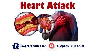 Heart Attack  Myocardial Infraction  MI [upl. by Metzger30]