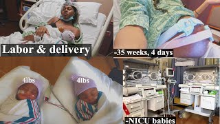 TWIN PREGNANCY LABOR amp DELIVERY  week 35  VERY UNEXPECTED [upl. by Nalced]