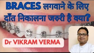 Braces Ke Pahle Daant Nikalana Jaruri Hai Kya Tooth Extraction Before Braces [upl. by Shuping]