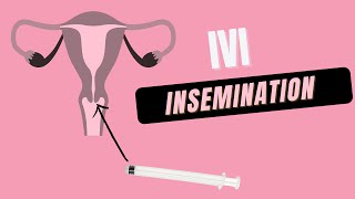 How to do at Home IVI Insemination [upl. by Seppala]