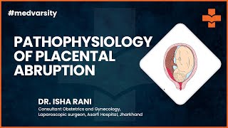 Pathophysiology of Placental Abruption  Case Discussion [upl. by Akkimat]