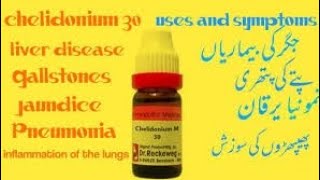 How to use Chelidonium Homeopathic Medicine For Healthy LiverDrkirtivikramsinghbyDr Adil Farooq [upl. by Nahtad342]