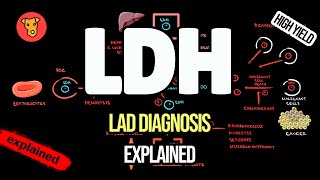 LACTATE DEHYDROGENASE Clinical significance Why LDH increase [upl. by Hairabez]