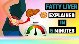 The Shocking Fatty Liver Truth EXPERTS Are Hiding [upl. by Wey]