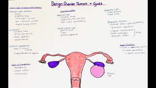 Benign Ovarian Tumors  Ovarian Cysts  histology  clinics [upl. by Nonregla]