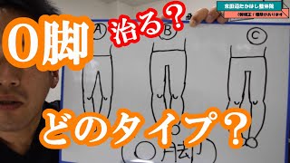 O脚のタイプ O脚にも色々ある。治る？治りにくい？ 京田辺市松井山手の「京田辺たかはし整体院」整体、産後骨盤矯正、O脚矯正 [upl. by Eelarbed]