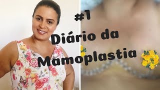 MAMOPLASTIA sem SILICONE  PÓS OPERATÓRIO [upl. by Romonda]