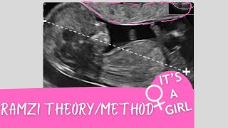 Its baby girl ultrasound  RAMZI THEORY  method [upl. by Teik]