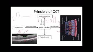 OPHTHALMOLOGY PG TEACHING PROGRAM DODNBMDMS  OCT POSTERIOR SEGMENT [upl. by Treiber]