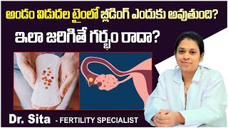 ఆ సమయంలో రక్తస్రావం  What Causes Bleeding During Ovulation  Ovulation Bleeding  Boon Fertility [upl. by Enecnarf581]